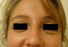 Μια καινούρια ζωή θα μπορέσει να αρχίσει…