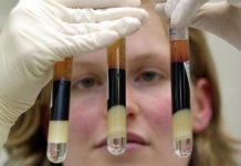 Ελπίδες για αποτελεσματικότερες θεραπείες δίνει η ανακάλυψη γονιδίων που προκαλούν μεταστάσεις