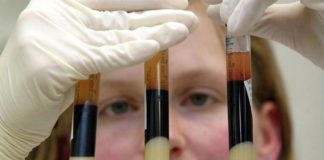 Ελπίδες για αποτελεσματικότερες θεραπείες δίνει η ανακάλυψη γονιδίων που προκαλούν μεταστάσεις