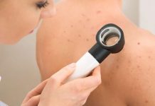 Δωρεάν δερματολογικός έλεγχος στα μέλη των ΚΑΠΗ Βούλας, Βάρης, Βουλιαγμένης